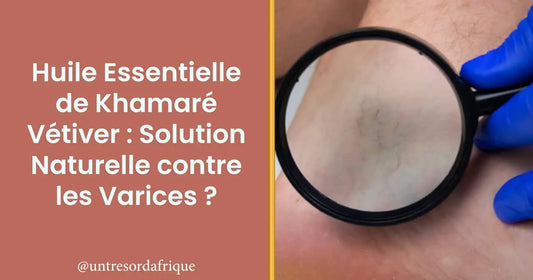 Huile Essentielle de Khamaré Vétiver : Solution Naturelle contre les Varices ?